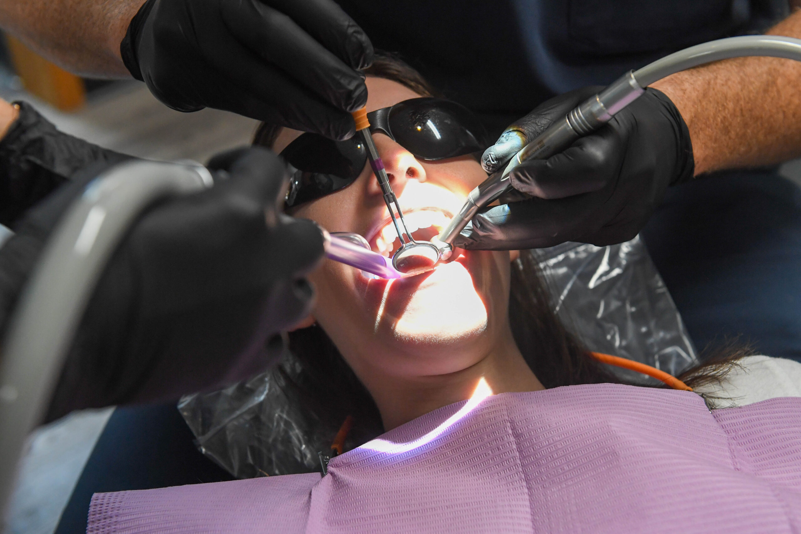 A dentist patient being worked on, three hands are visible, each holding a tool while the patient's mouth is open